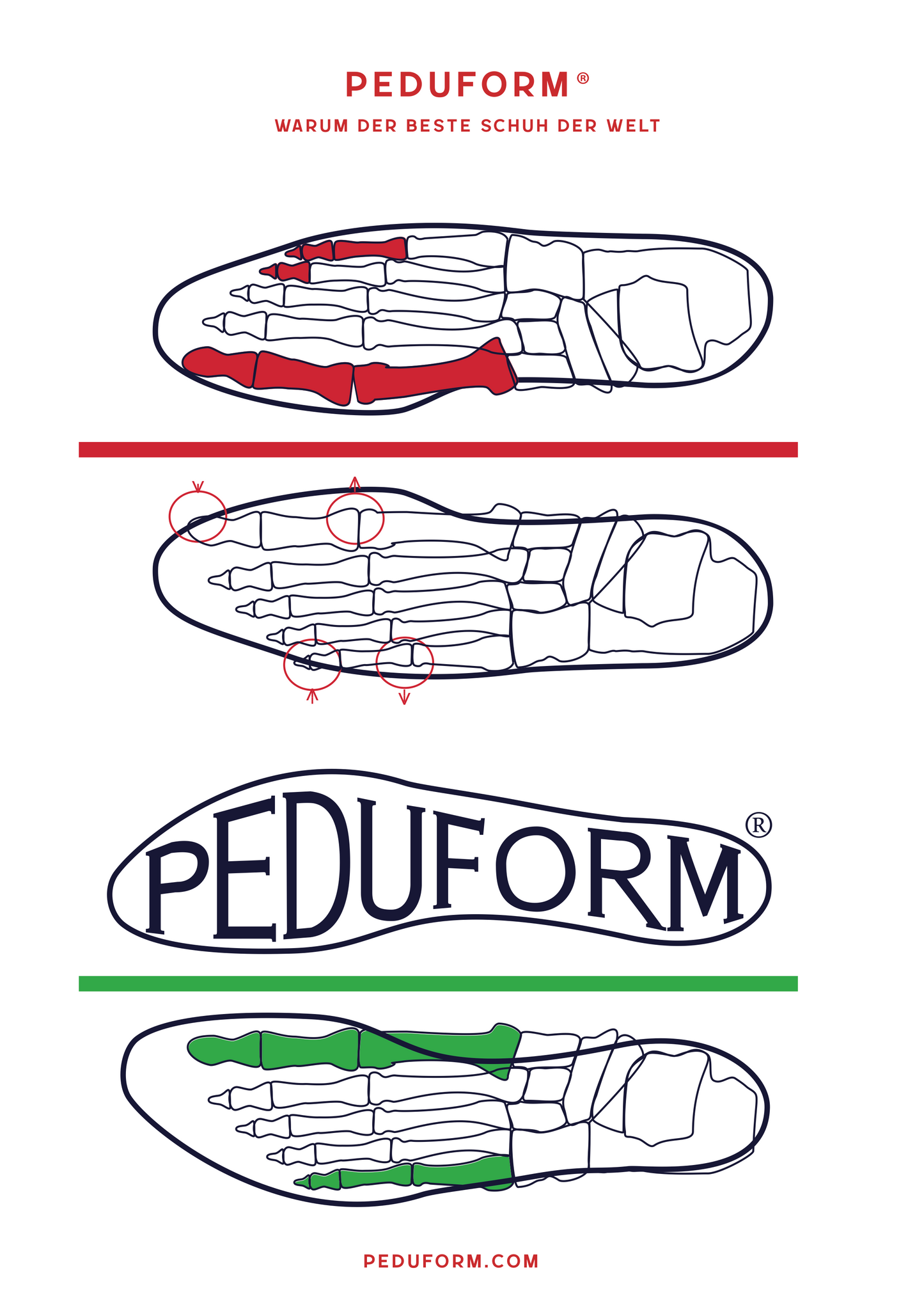 gegenüberstellende Abbildung falscher/herkömmlicher und richtiger/Peduform Schuhform